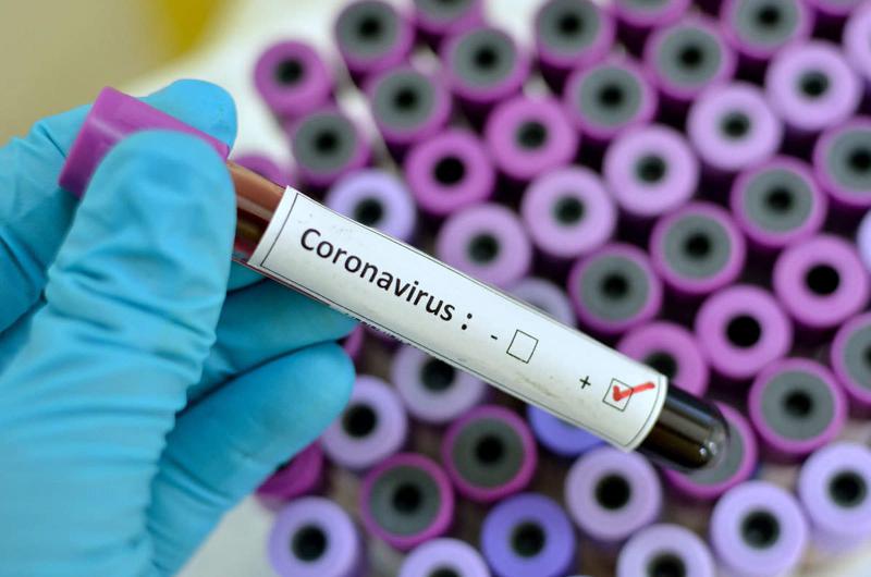 Правда ли что коронавирус передается через деньги и как обезопасить себя